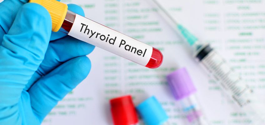 blood sample for thyroid panel test
